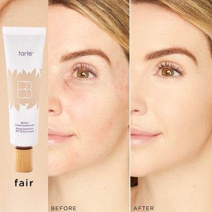 Tarte BB Blur Tinted Moisturizer SPF 30 | Natural Matte Finish | Buildable Coverage-A0026
