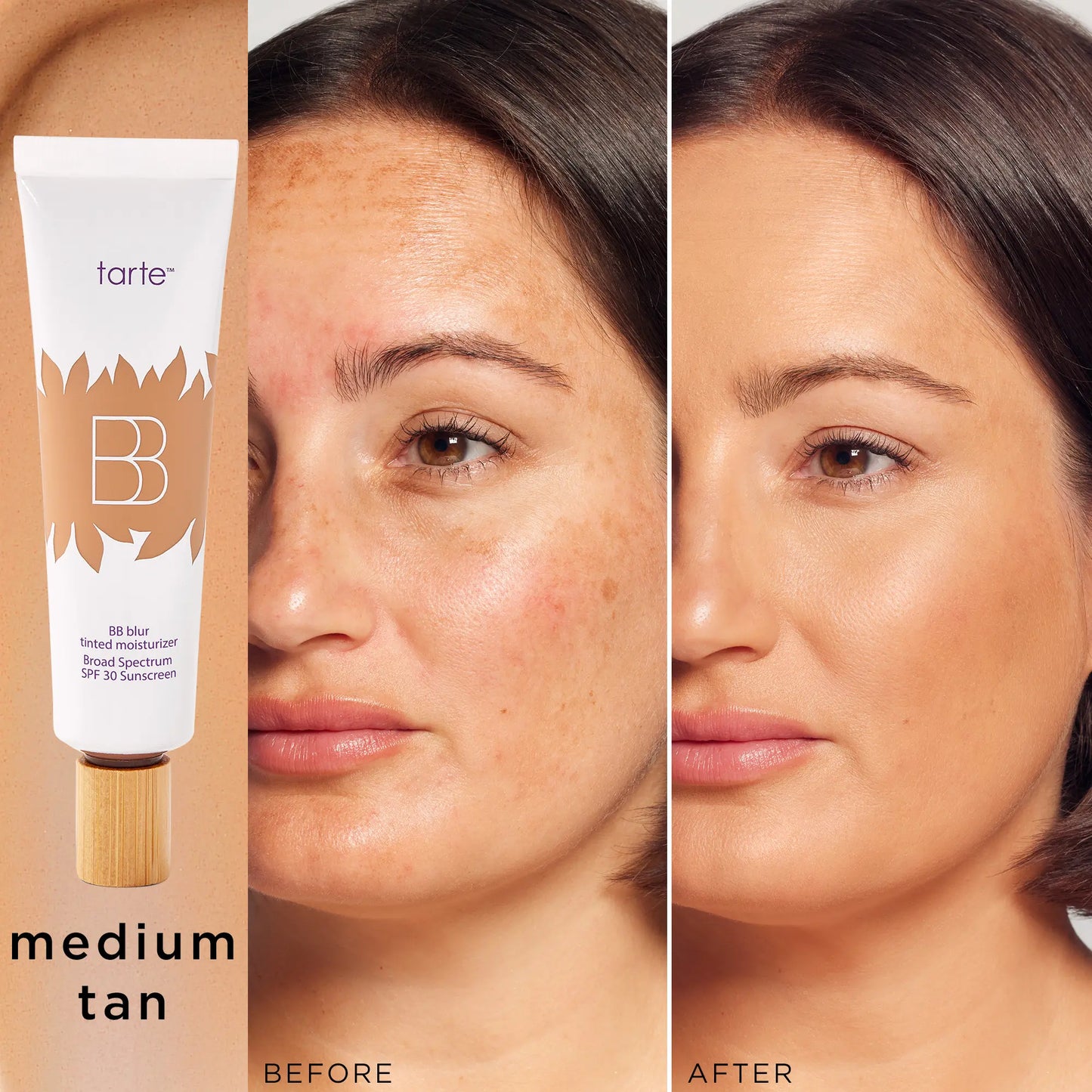 Tarte BB Blur Tinted Moisturizer SPF 30 | Natural Matte Finish | Buildable Coverage-A0026