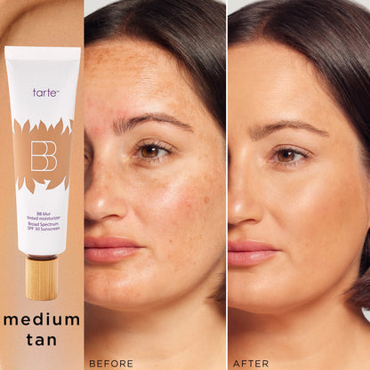 Tarte BB Blur Tinted Moisturizer SPF 30 | Natural Matte Finish | Buildable Coverage-A0026