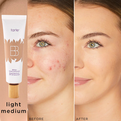 Tarte BB Blur Tinted Moisturizer SPF 30 | Natural Matte Finish | Buildable Coverage-A0026
