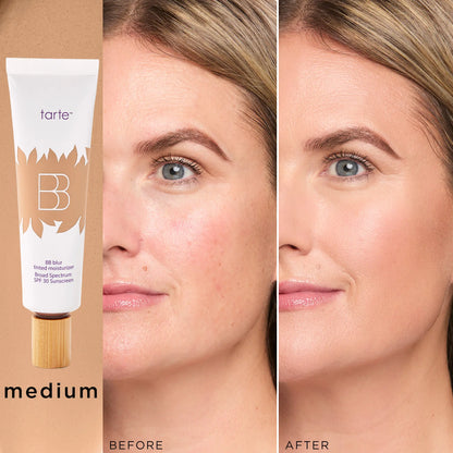 Tarte BB Blur Tinted Moisturizer SPF 30 | Natural Matte Finish | Buildable Coverage-A0026